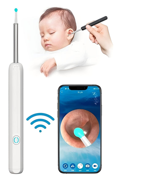 Earwax Removal Kit