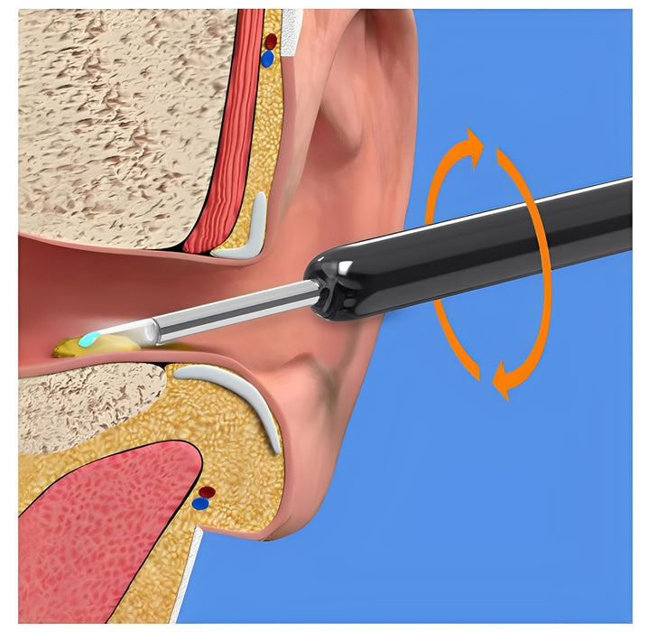 Earwax Removal Kit
